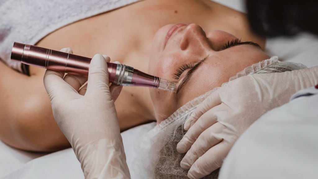 Microneedling